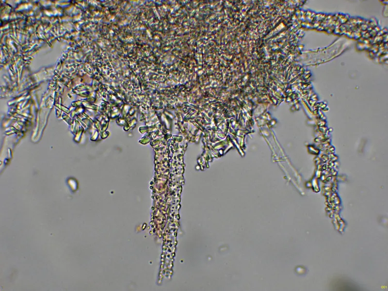 Asterostromella epiphylla 10 - Hifas con cristalizaciones subiculares-001